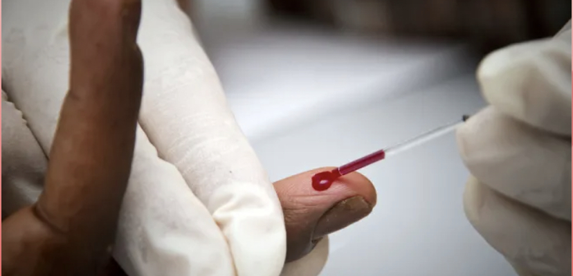 You are currently viewing VIH Sida : 754 Infections à Vélingara