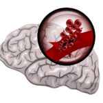 Lire la suite à propos de l’article PRISE EN CHARGE DE L’HEMOPHOBIE AU SENEGAL : 340 cas diagnostiqués sur une prévision  de 1700 cas