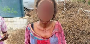 Lire la suite à propos de l’article Ministère de la Santé : En sang, une femme et son enfant battus par un vigile