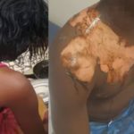 Lire la suite à propos de l’article Drame conjugal à Yeumbeul : un homme ébouillanté par sa femme